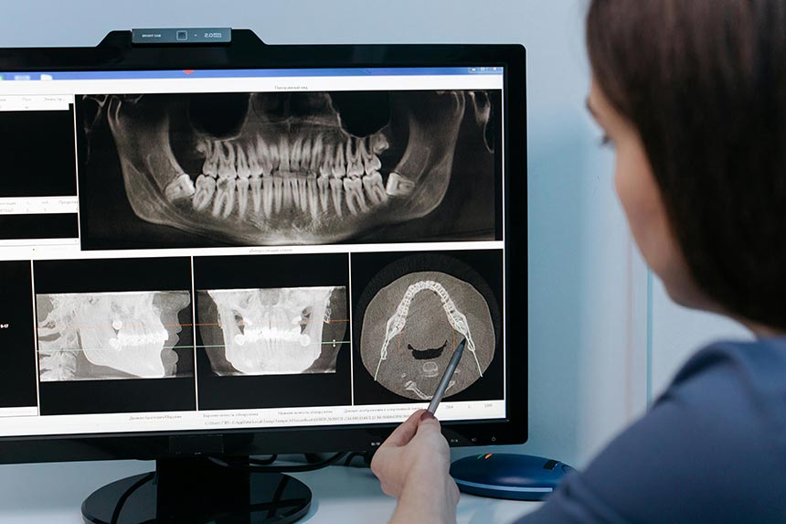 Dentist reviewing digital dental X-rays for treatment planning